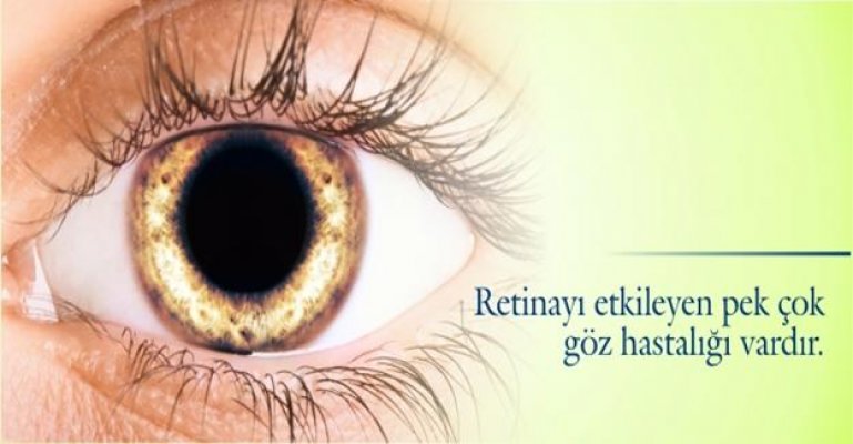 Retina hastalıkları körlüğe kadar gidiyor